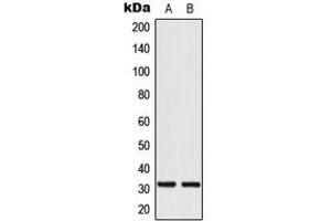 Western blot analysis of MRPL24 expression in HeLa (A), HepG2 (B) whole cell lysates. (MRPL24 Antikörper  (Center))