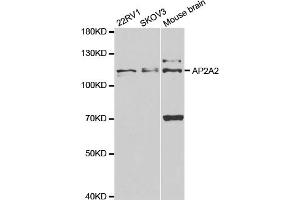 Western blot analysis of extracts of various cell lines, using AP2A2 antibody (ABIN5973124) at 1/1000 dilution. (AP2A2 Antikörper)