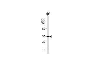 Western blot analysis of lysate from RD cell line,using EDA Antibody (N-term) (ABIN390232 and ABIN2840705). (Ectodysplasin A Antikörper  (N-Term))