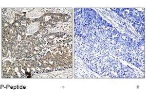 Image no. 3 for anti-DOK2 (DOK2) (pTyr299) antibody (ABIN197044) (DOK2 Antikörper  (pTyr299))