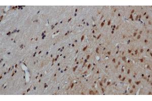 Immunohistochemistry of paraffin-embedded Mouse brain using GRP Polyclonal Antibody at dilution of 1:50 (Gastrin-Releasing Peptide Antikörper)