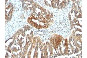 Image no. 2 for anti-Vascular Endothelial Growth Factor A (VEGFA) antibody (ABIN6168158) (VEGFA Antikörper)
