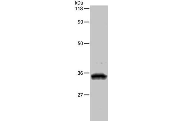 Uroplakin 3B Antikörper