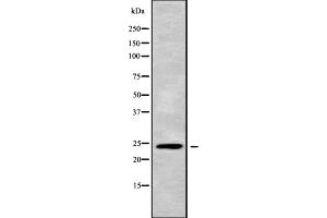 Western blot analysis APOBEC3H using A549 whole cell lysates. (APOBEC3H Antikörper)