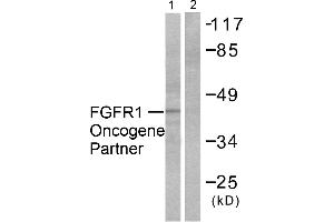 Western blot analysis of extracts from HepG2 cells, using FGFR1 Oncogene Partner antibody (#C0190). (FGFR1OP Antikörper)