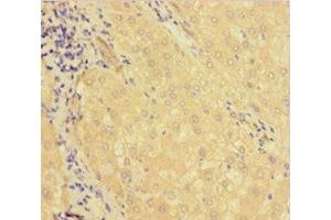 Immunohistochemistry of paraffin-embedded human liver tissue using ABIN7158728 at dilution of 1:100 (KDM1B Antikörper  (AA 451-544))