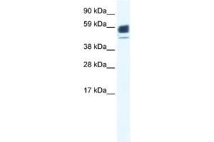 WB Suggested Anti-CHRNA1 Antibody Titration:  0. (CHRNA1 Antikörper  (N-Term))