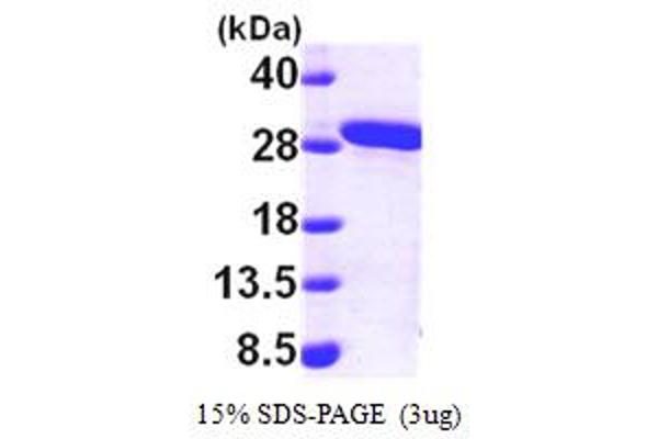 MMAB Protein (AA 33-250) (His tag)