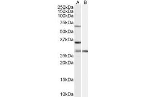 Western Blotting (WB) image for anti-Pre-mRNA Processing Factor 31 (PRPF31) (Internal Region) antibody (ABIN2466149) (PRPF31 Antikörper  (Internal Region))