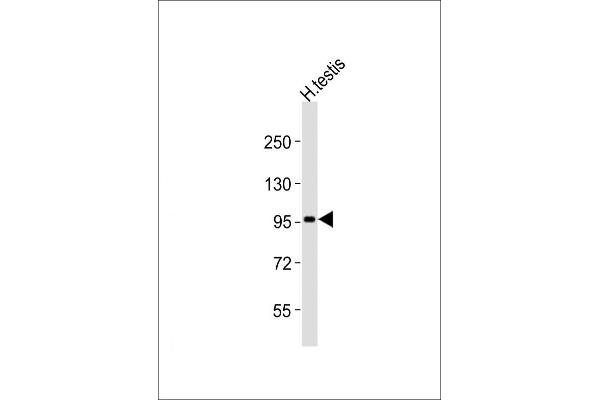 USP13 Antikörper  (AA 389-419)