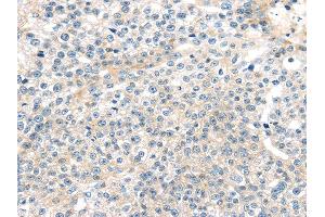 Immunohistochemistry (IHC) image for anti-Tumor Necrosis Factor, alpha-Induced Protein 8 (TNFAIP8) antibody (ABIN5958018) (TNFAIP8 Antikörper)