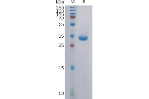 Human GC Protein, mFc Tag on SDS-PAGE under reducing condition. (GPRC5C Protein (AA 27-50) (mFc Tag))
