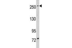 Western blot analysis of LRRK1 in mouse bladder tissue lysate (LRRK1 Antikörper  (AA 1981-2015))