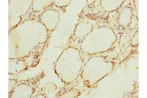 Immunohistochemistry of paraffin-embedded human thyroid tissue using ABIN7159887 at dilution of 1:100 (TIMM1B (AA 1-103) Antikörper)