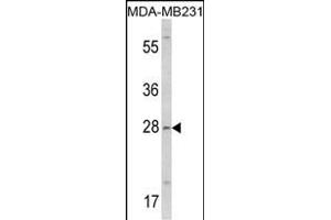 Western blot analysis of COLEC11 Antibody (N-term) (ABIN390822 and ABIN2841053) in MDA-M cell line lysates (35 μg/lane). (COLEC11 Antikörper  (N-Term))