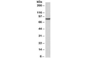 Western blot testing of A431 cell lysate with gamma-Catenin antibody at 2ug/ml. (JUP Antikörper  (Biotin))