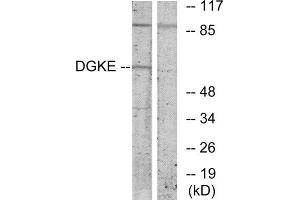 Western Blotting (WB) image for anti-Diacylglycerol Kinase, epsilon 64kDa (DGKE) (Internal Region) antibody (ABIN1849433) (DGKE Antikörper  (Internal Region))