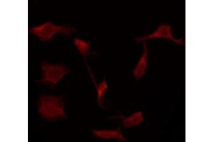 ABIN6276058 staining Hela by IF/ICC. (TACR1 Antikörper  (Internal Region))