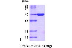 AKR1C3 Protein (AA 1-323) (His tag)