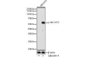 Western blot analysis of extracts of NIH/3T3 cells, using Phospho-Akt-S473 antibody (ABIN7265522) at 1:1000 dilution. (AKT 1/2/3 Antikörper  (pSer472))