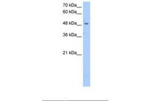 Image no. 1 for anti-Sjogren Syndrome Antigen B (SSB) (AA 171-220) antibody (ABIN320554) (SSB Antikörper  (AA 171-220))