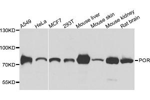 Western blot analysis of extracts of various cell lines, using POR antibody (ABIN5974791) at 1/1000 dilution. (POR Antikörper)
