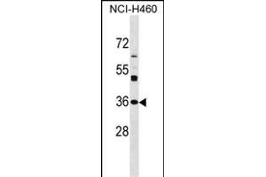 NAT6 Antibody (Center) (ABIN1537881 and ABIN2850382) western blot analysis in NCI- cell line lysates (35 μg/lane). (NAT6 Antikörper  (AA 150-179))