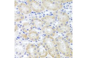 Immunohistochemistry of paraffin-embedded mouse kidney using ADIPOQ Antibody (ABIN5971370) at dilution of 1/100 (40x lens). (ADIPOQ Antikörper)