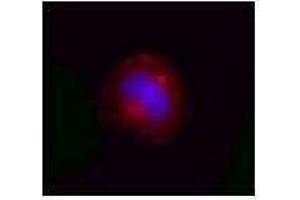 Immunofluorescence (IF) image for anti-Valosin Containing Protein (VCP) antibody (ABIN2666418) (VCP Antikörper)