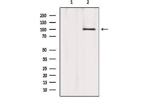 Western blot analysis of extracts from 293, using ATP2A1 Antibody. (ATP2A1/SERCA1 Antikörper  (Internal Region))