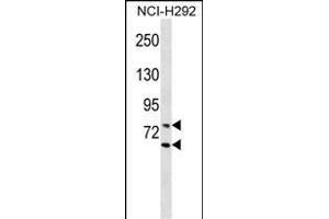 LMNA Antibody (Center) (ABIN1538393 and ABIN2849814) western blot analysis in NCI- cell line lysates (35 μg/lane). (Lamin A/C Antikörper  (AA 401-427))