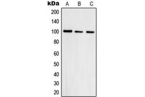 Western blot analysis of Topoisomerase 3 beta1 expression in HepG2 (A), A431 (B), HeLa (C) whole cell lysates. (Topoisomerase 3 Beta1 (N-Term) Antikörper)