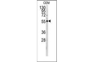 Western blot analysis of anti-PKM2 Antibody (C-term) in CEM cell line lysates (35ug/lane). (PKM2 Antikörper  (C-Term))