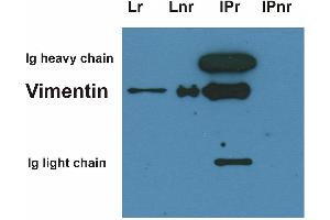 Western Blotting (WB) image for anti-Vimentin (VIM) antibody (ABIN94491)