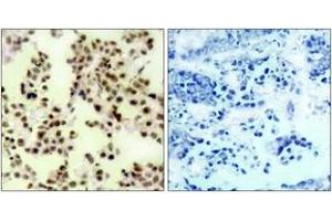 Immunohistochemistry (IHC) image for anti-Tumor Protein P73 (TP73) (pTyr99) antibody (ABIN2888508) (Tumor Protein p73 Antikörper  (pTyr99))