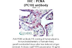 Image no. 1 for anti-Proliferating Cell Nuclear Antigen (PCNA) antibody (ABIN1724017) (PCNA Antikörper)