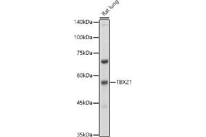 Western blot analysis of extracts of Rat lung, using TBX21 antibody (ABIN1682974, ABIN3019139, ABIN3019140 and ABIN6220736) at 1:500 dilution. (T-Bet Antikörper  (AA 326-535))