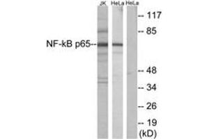 Western blot analysis of extracts from Jurkat/HeLa, using NF-kappaB p65 (Ab-529) Antibody. (NF-kB p65 Antikörper  (AA 496-545))