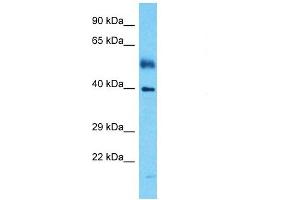 Host:  Rabbit  Target Name:  IRF1  Sample Tissue:  Human Esophagus Tumor  Antibody Dilution:  1ug/ml (IRF1 Antikörper  (Middle Region))