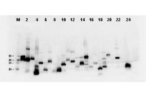 Twenty-four (24) clones were randomly selected and grown up from glycerol stocks by inoculating 0. (DYKDDDDK Tag Antikörper)