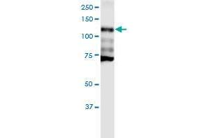 Western Blotting (WB) image for anti-Cadherin 1, Type 1, E-Cadherin (Epithelial) (CDH1) (AA 381-480) antibody (ABIN560274)