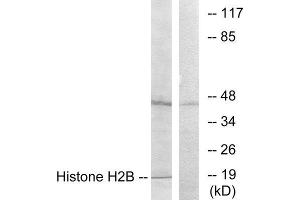 Western Blotting (WB) image for anti-Histone H2B (N-Term) antibody (ABIN1849874) (Histone H2B Antikörper  (N-Term))