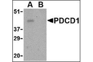 Western blot analysis of PD-1 in THP-1 cell lysate with this product at 1 μg/ml in the (A) absence and (B) presence of blocking peptide. (PD-1 Antikörper  (Center))