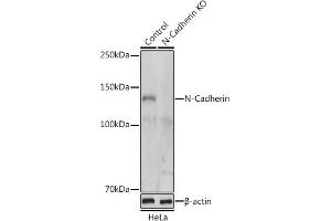 Western blot analysis of extracts from normal (control) and N-Cadherin knockout (KO) HeLa cells, using N-Cadherin antibody (ABIN1684127, ABIN1514384, ABIN5663657 and ABIN6213846) at 1:500 dilution. (N-Cadherin Antikörper  (AA 450-550))