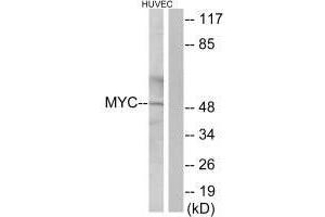 Western blot analysis of extracts from HUVEC cells, using Myc antibody. (c-MYC Antikörper  (C-Term))