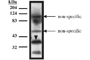 Western blot analysis using TUP1 antibody on recombinant TUP1 protein (amino acids 1-200) expressed in Mav108 cells. (HIRA Antikörper)