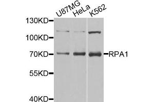 Western blot analysis of extracts of various cell lines,using RPA1 antibody. (RPA1 Antikörper)