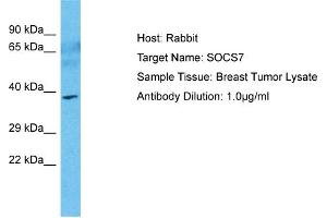 Host: Rabbit Target Name: SOCS7 Sample Type: Breast Tumor lysates Antibody Dilution: 1. (SOCS7 Antikörper  (N-Term))
