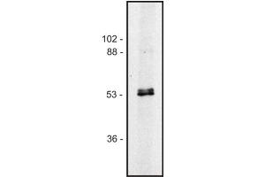 Western blot of human Jurkat T cell line (Alpha, beta-Tubulin Dimer Antikörper)