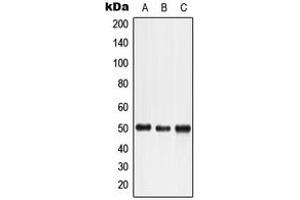 Western blot analysis of LTBR expression in HeLa (A), HuT78 (B), K562 (C) whole cell lysates. (LTBR Antikörper  (N-Term))